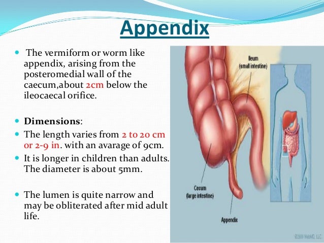 Appendicectomy 