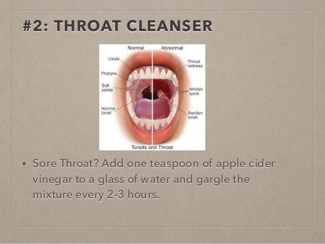 Natural Cures For Sore Throat During Pregnancy Natural Cures For Sore Throat During Pregnancy