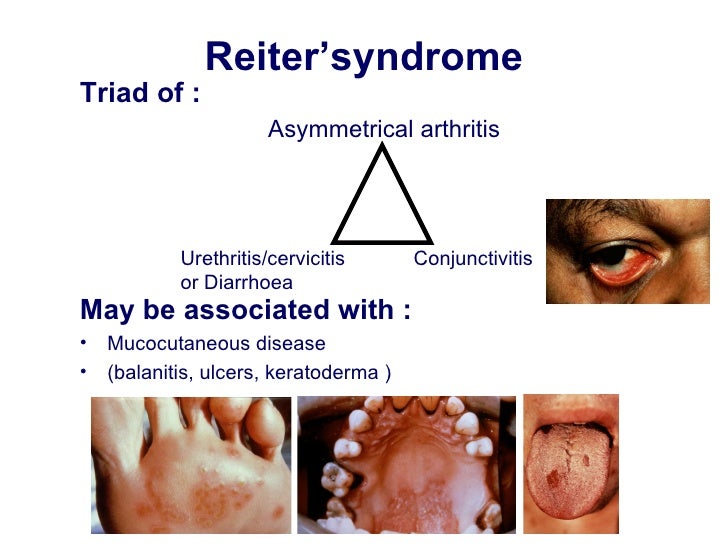 What is systemic disease? | Reference.com