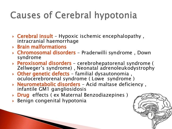 Approach to floppy infant