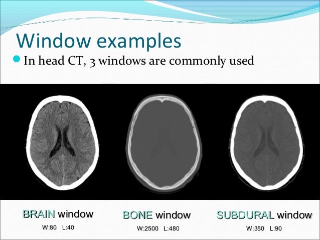 ct scan vs mri