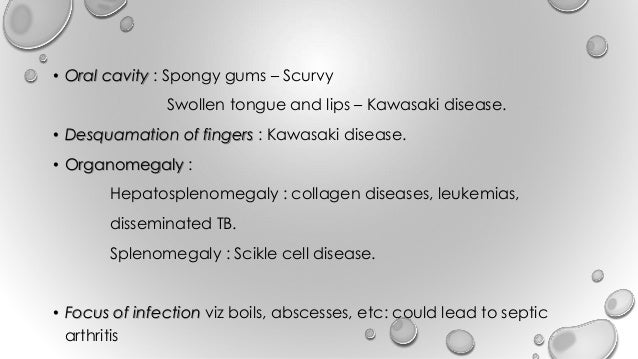 Zithromax For Child