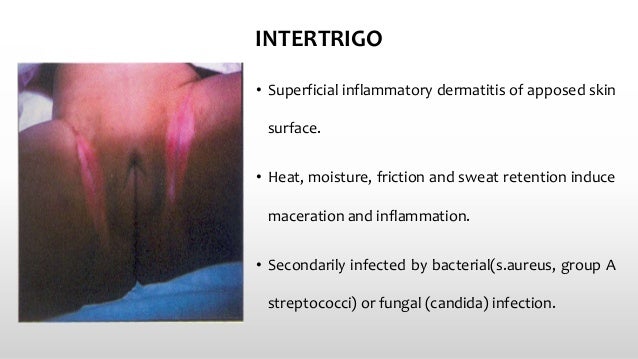 rash in skin fold - Mamapedia™