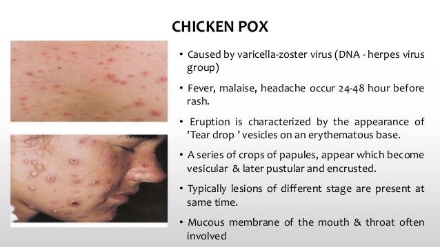 Skin Infection Natural Treatment Garlic Skin Infection Natural Treatment Garlic