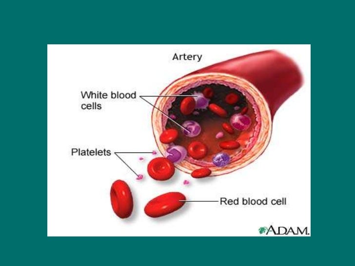 stroke reason kidney failure