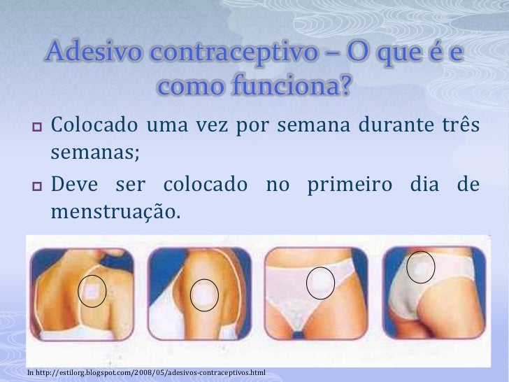 Métodos Contraceptivos Hormonais ou Químicos Artesanato Goiano ~ Métodos Contraceptivos Hormonais ou Químicos