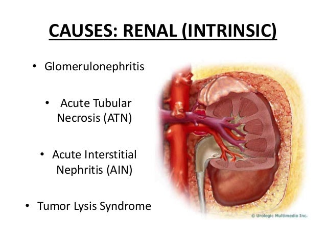 Fresenius dialysis knoxville kidney troubles food plan
