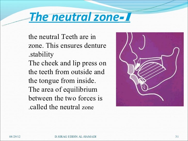 Arrangement of artificial teeth 1
