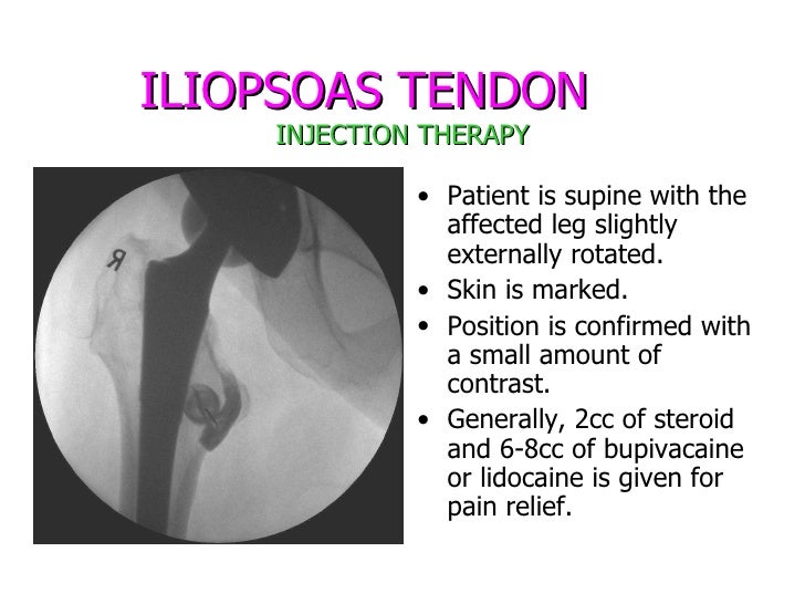 Arthrograms Presentation