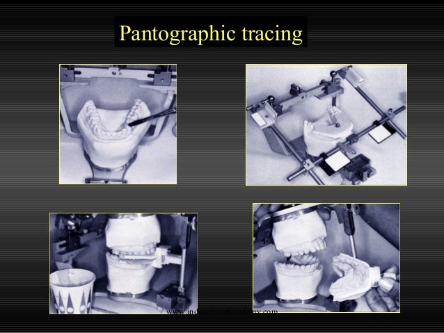 Straight Line Articulator : Articulators cosmetic dentistry training