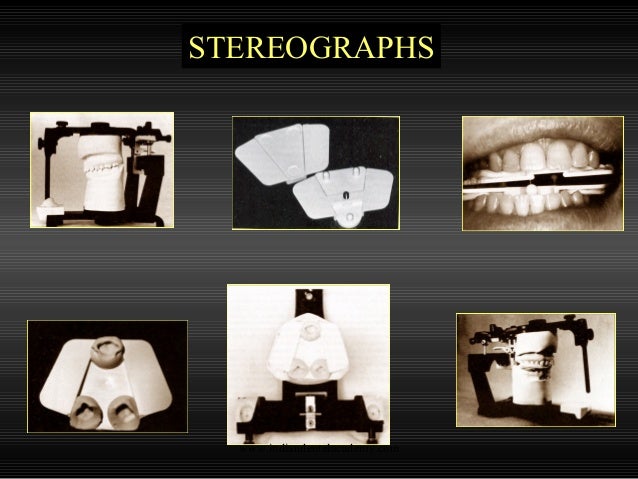 Straight Line Articulator : Articulators cosmetic dentistry training