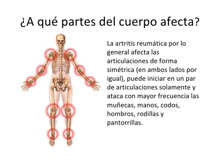 El tratamiento de la psoriasis de la cabeza al niño