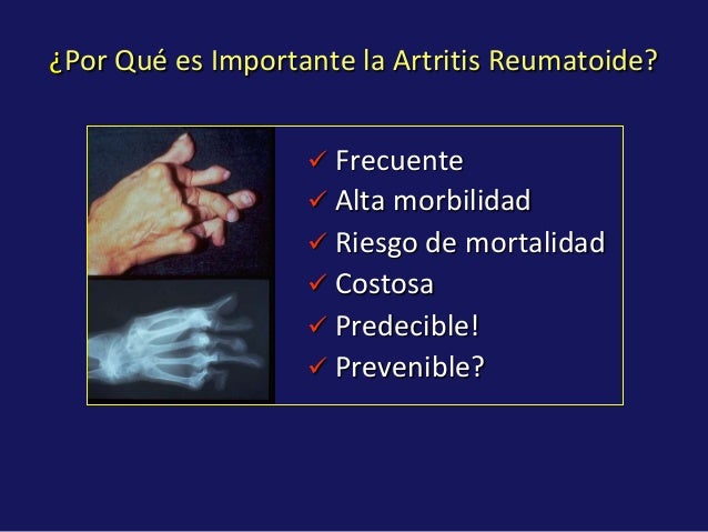 La sosa a la psoriasis las revocaciones