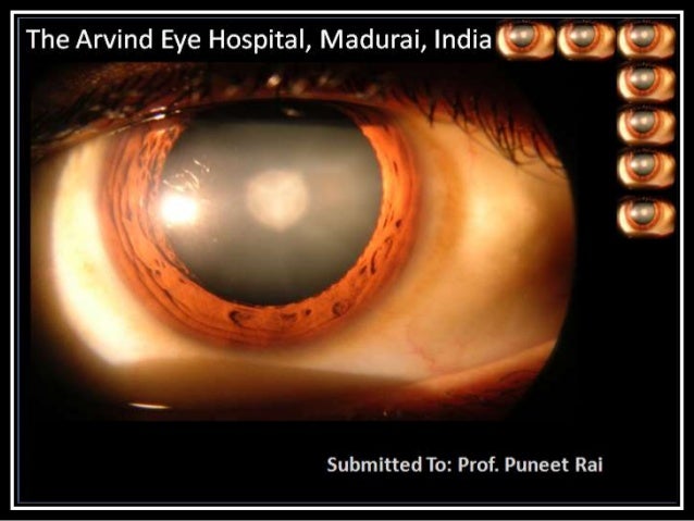 aravind eye hospital case study solution View the step-by-step solution to: in aravind eye care hospital's case, the raised or presented issue is all in regards to being able to accommodate a well established or founded. aravind eye hospital case study solution View the step-by-step solution to: in aravind eye care hospital's case, the raised or presented issue is all in regards to being able to accommodate a well established or founded.