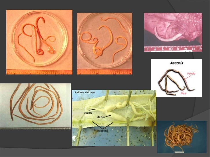 alimentos que provocan migra a ascaris lumbricoides y trichuris trichiura alimentos que provocan migra a ascaris lumbricoides y trichuris trichiura