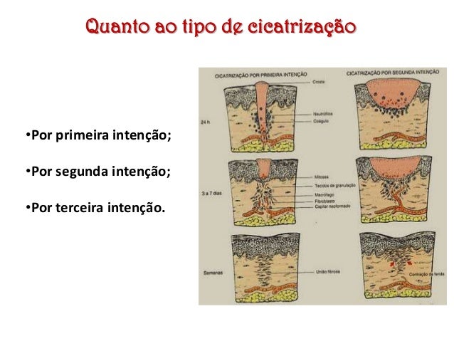 As feridas...