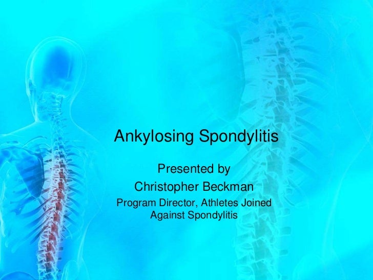 Diets For Ankylosing Spondylitis