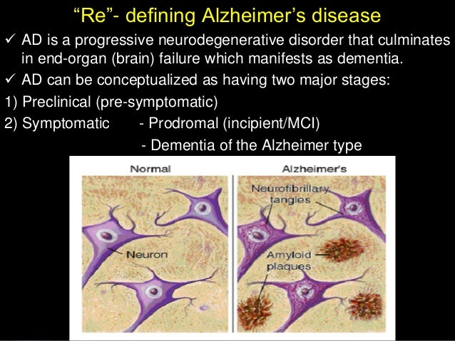 biomarker diagnosis for alzheimer 39 s disease stages of dementia progression chart