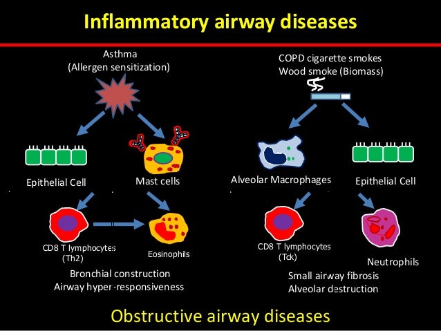 What Is Nocturnal Asthma photo images What Is Nocturnal Asthma