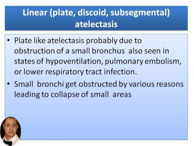 Atelectasis/Lung Collapse Part-1 by Dr Bashir Ahmed Dar Associate Pro…