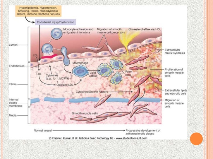 pathogenic etiology of atherosclerosis Download citation | the pathogenesis of | atherosclerosis and its complications, such as myocardial infarction, stroke, and peripheral vascular disease, remain major causes of morbidity and mortality in the western world coronary heart disease alone accounts for over half a million deaths i. pathogenic etiology of atherosclerosis Download citation | the pathogenesis of | atherosclerosis and its complications, such as myocardial infarction, stroke, and peripheral vascular disease, remain major causes of morbidity and mortality in the western world coronary heart disease alone accounts for over half a million deaths i.