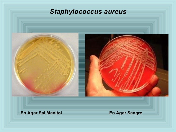 Atlas microbiologia-