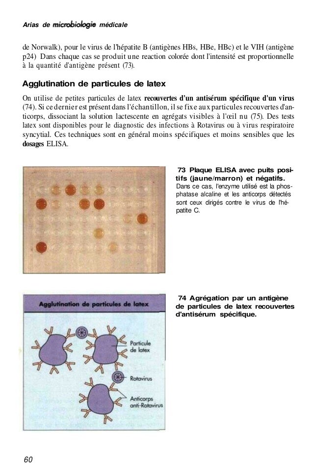 Ropinirole Us Pharmacy