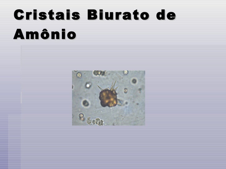 Biurato De Amonio Em Urina Significado Clinico