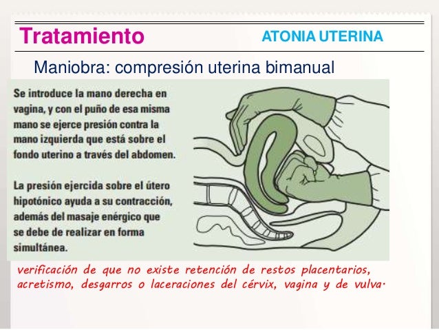 Cytotec Administration For Abortion