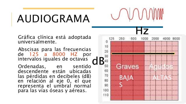 Diferencia Entre Master 1000 Y 500