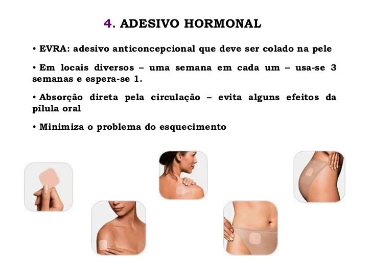 Aula 3 DSTs e métodos anticoncepcionais Aparador Vermelho Etna ~ Aula 3 DSTs e métodos anticoncepcionais
