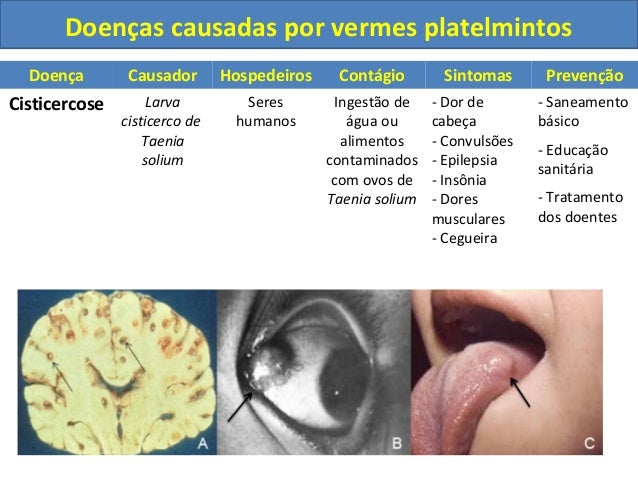 A espécie de vermes e do que tratá-los