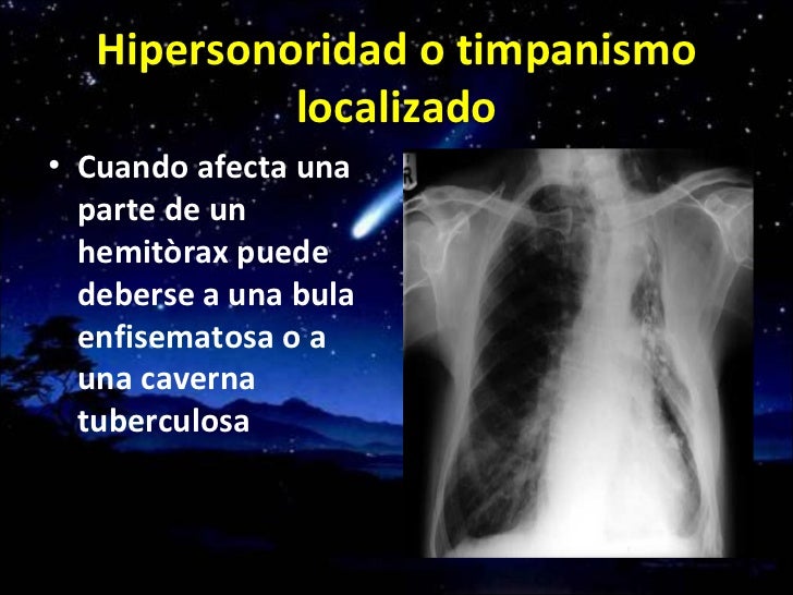Auscultaciòn pulmonar