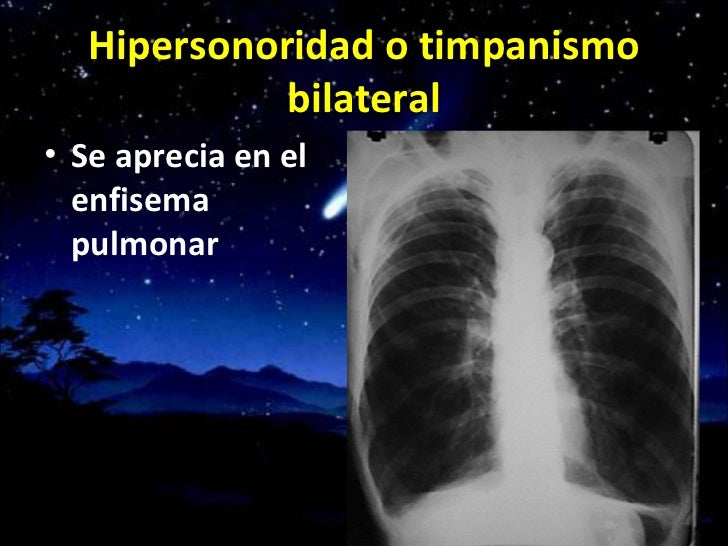 Auscultaciòn pulmonar