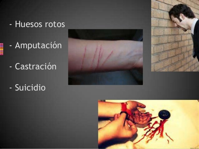 Anariti el champú especial contra la caída de los cabello