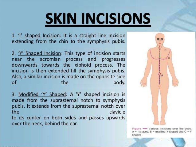 Autopsy internal examination, Forensic Medicine, Post-mortem Examinat…