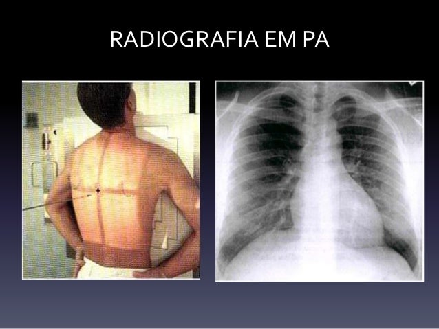 Avaliação sistemática da radiografia do tórax