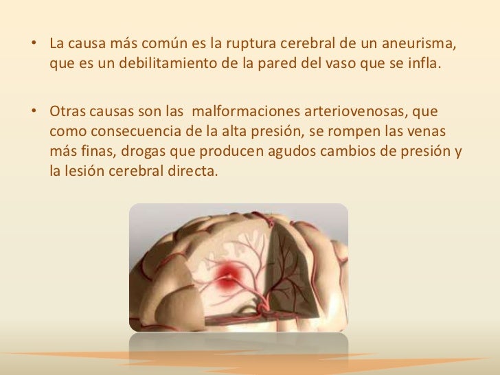 Sheynyy la osteocondrosis el tratamiento en ryazani