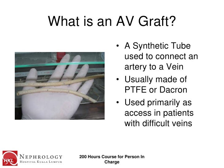 Av grafts and hemodialysis catheters vistana