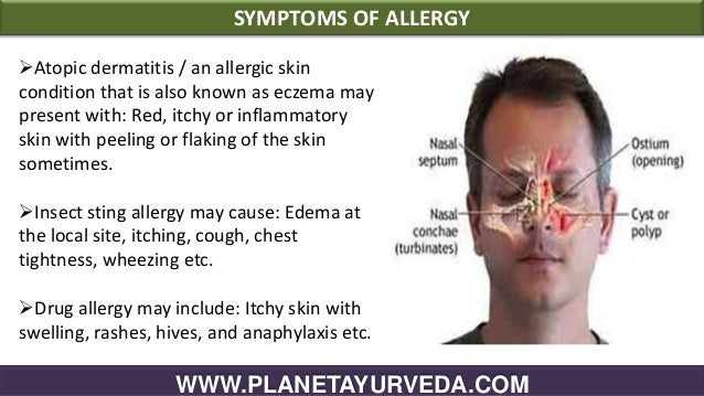 Ayurvedic treatment for allergies with home remedies Ayurvedic treatment for allergies with home remedies