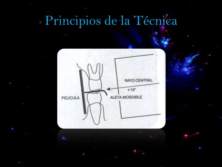 Azeneth técnica de aleta mordible