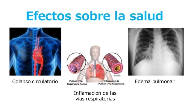 Azufre En El Cuerpo Humano Exceso