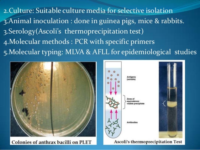 Cipro Anthrax Poisioning