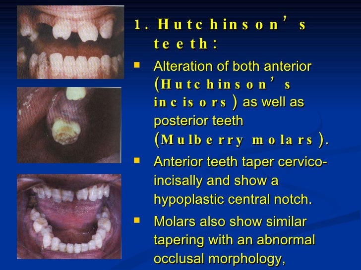 Bacterial, Viral & Mycotic Infections
