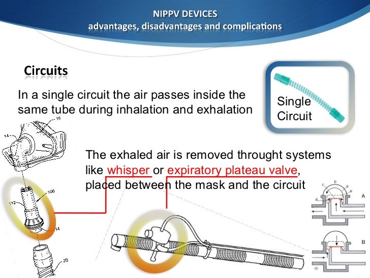Noninvasive ventilation devices management
