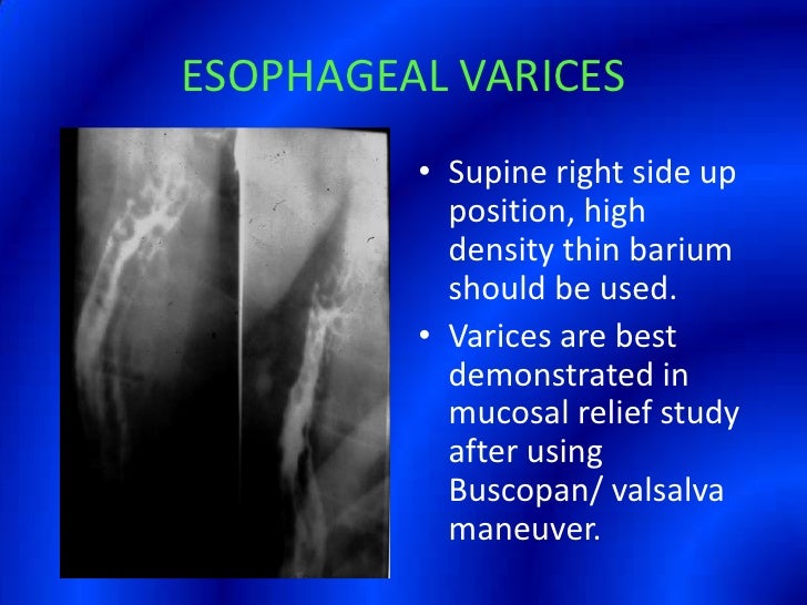 Barium Swallow Presentation