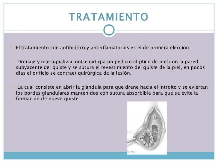 El régimen a la eccema de los pies