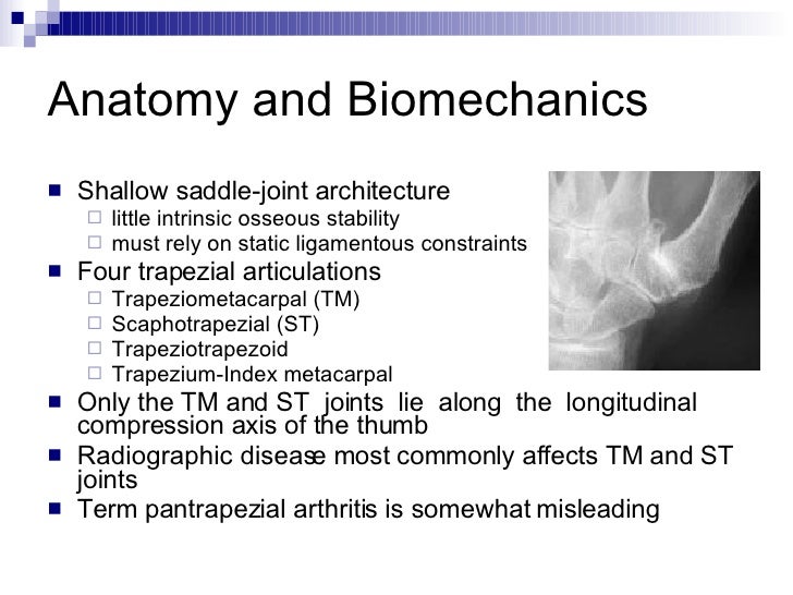 Basal Joint Arthritis Of The Thumb