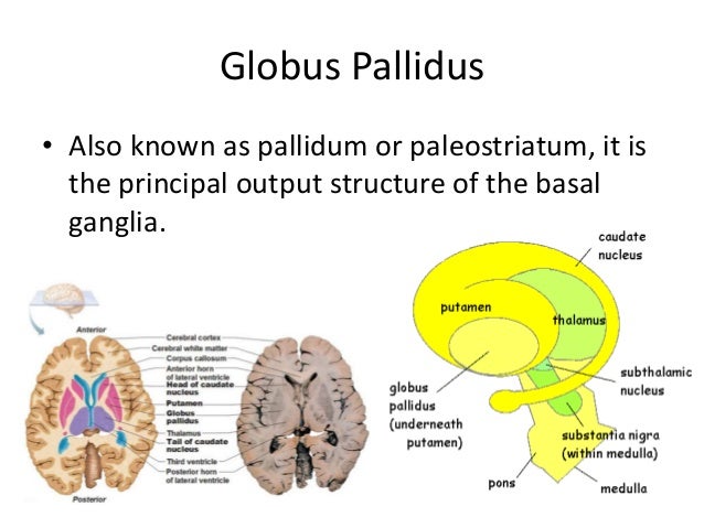 Mild stroke in italiano acute stroke can also result from