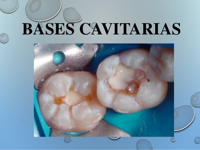 Bases cavitarias